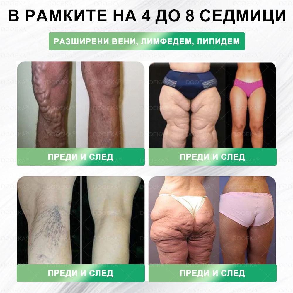 📉 DOOEKA® GLP-1 8-в-1 Фит & Витал орален разтвор | Само веднъж на ден. Видими резултати само за 7 дни. | За затлъстяване и контрол на теглото, сърдечно-съдово здраве, диабет, сънна апнея, здраве на червата, проблеми със ставите и други.